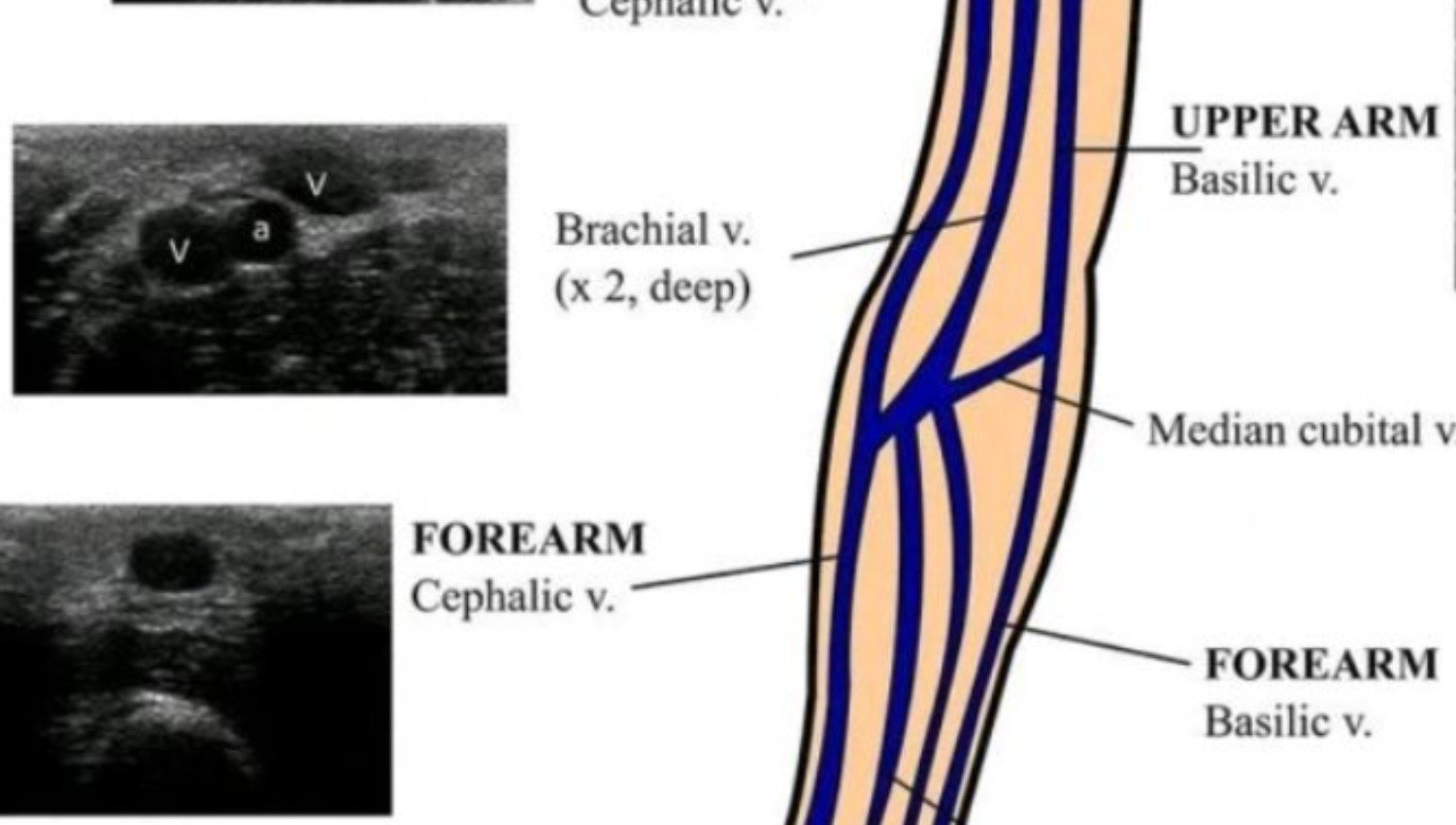 GAhouses119冊 Outsunny 11' x 9' Metal Garden Shed Utility Tool Storage